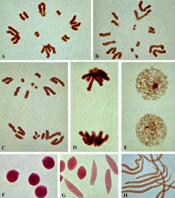 Tipos de meiosis Tipos de meiosis