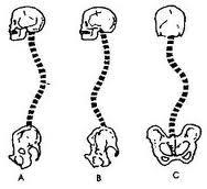 espalda11 Método Pilates: Hiperlordosis, hipercifosis y la salud de la espalda