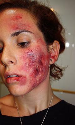 IDEAS PARA HALLOWEEN: QUEMADURAS IDEAS PARA HALLOWEEN: QUEMADURAS