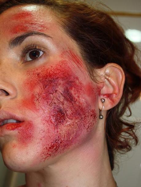 IDEAS PARA HALLOWEEN: QUEMADURAS IDEAS PARA HALLOWEEN: QUEMADURAS