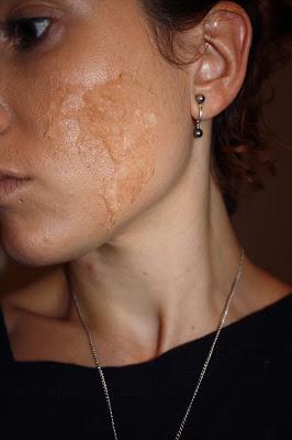 IDEAS PARA HALLOWEEN: QUEMADURAS IDEAS PARA HALLOWEEN: QUEMADURAS