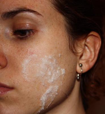 IDEAS PARA HALLOWEEN: QUEMADURAS IDEAS PARA HALLOWEEN: QUEMADURAS