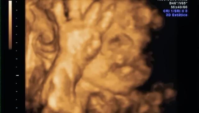 Progreso de embarazo =) Progreso de embarazo =)