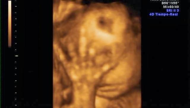 Progreso de embarazo =) Progreso de embarazo =)