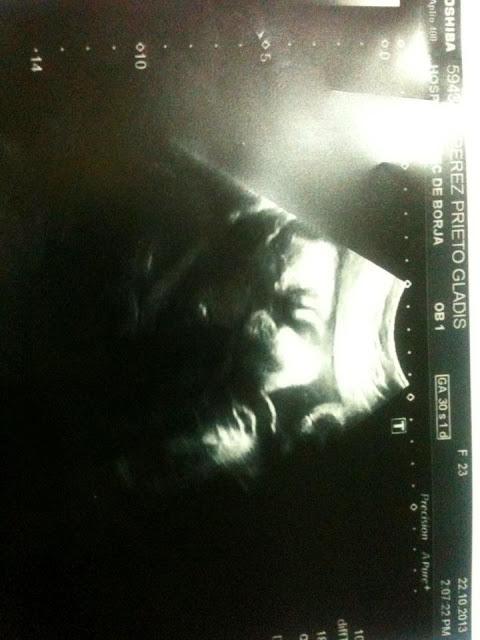 Progreso de embarazo =) Progreso de embarazo =)