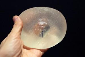 Sanidad recomienda a las mujeres que portan prótesis PIP su retirada Prótesis-PIP