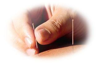 ACUPUNTURA / Técnicas en las alteraciones de la columna lumbar Acupunturacurso