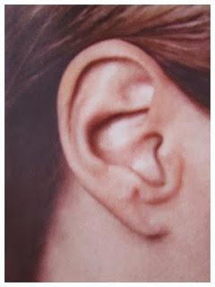 La pérdida de oído (2)