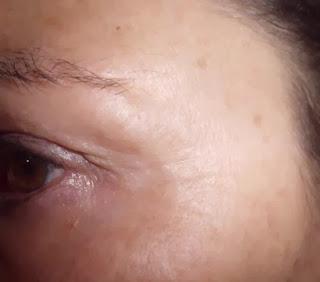 Summum Correction Gotas Cumlaude. piel sin manchas