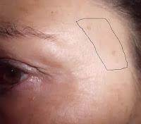 Summum Correction Gotas Cumlaude. piel con manchas mas claras