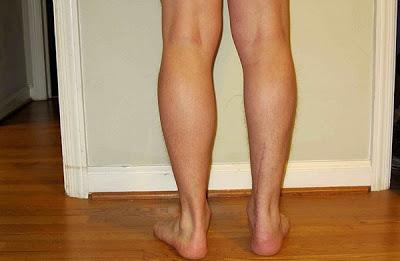 Por ejemplo tras una operación Fortalecer los gemelos en casa