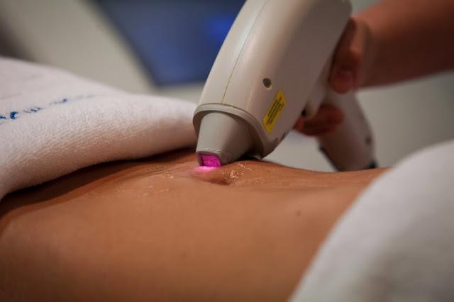 Todo sobre la DERMOPLASTIA Todo sobre la DERMOPLASTIA