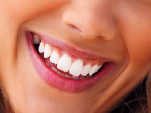 Sonrisa_Blanqueamiento SmartSalus Blanqueamiento