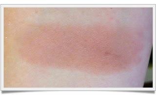 VARIADILLO... VARIADILLO...