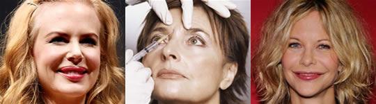 Botox, toxina botulinica