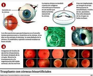 Prueban en 10 pacientes córneas fabricadas con colágeno humano