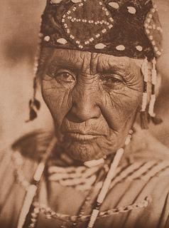 Cambio del vitreo por el envejecimiento Cambio del vitreo por el envejecimiento