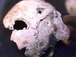 Los controvertidos restos del cráneo de Hitler