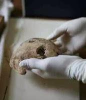 Los controvertidos restos del cráneo de Hitler