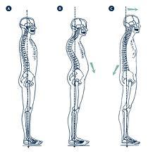 espalda4 Técnicas o entrenamiento para la espalda y mejorar la postura