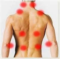 Punto Gatillo Punto Gatillo