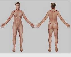 Punto Gatillo Punto Gatillo