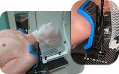 La radioterapia en el Cáncer de Cabeza y Cuello La radioterapia en el Cáncer de Cabeza y Cuello