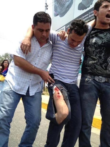 Masacran estudiantes en Venezuela!! URGENTE