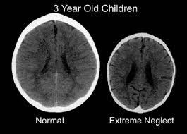 term paper on child abuse and neglect term paper on child abuse and neglect