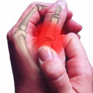 Vendaje casero para dolores Vendaje casero para dolores