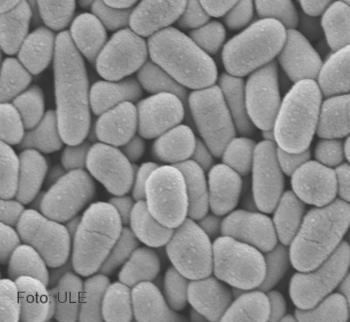 Determinan las especies de arsénico en agua subterránea Imagen al microscopio electrónico de bacterias corineformes (Corynebacterium glutamicum), utilizadas para acumular arsénico. Créditos ULE.