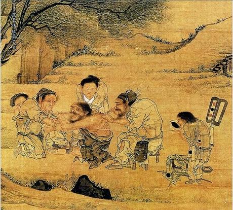 la acupuntura acupuntura,definicion acupuntura