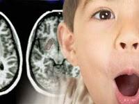 El estrés provoca daño en el cerebro del niño