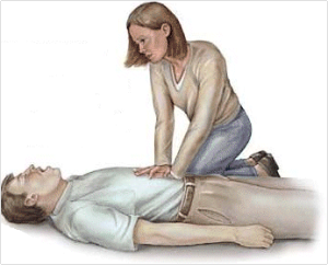 ¡Se está ahogando!, pues…hazle un Heimlich Heimlich insconsciente