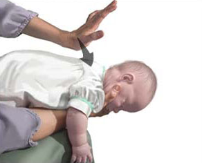 ¡Se está ahogando!, pues…hazle un Heimlich Bebé