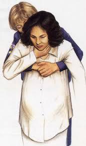 ¡Se está ahogando!, pues…hazle un Heimlich Heimlich embarazada