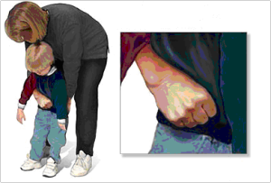 ¡Se está ahogando!, pues…hazle un Heimlich Heimlich niños