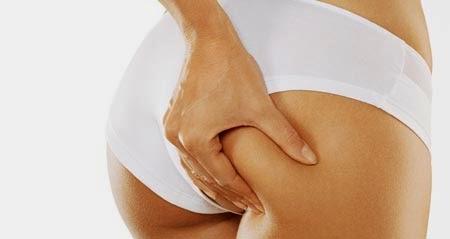 Cómo deshacerse de acné en los gluteos Cómo deshacerse de acné en los gluteos