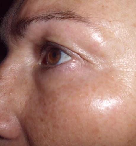 Germinal 3.0 Tratamiento Antiaging ampolla flash