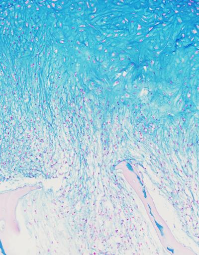 Ingenieros de Columbia desarrollan un cartílago humano funcional en laboratorio Cartílago humano funcional