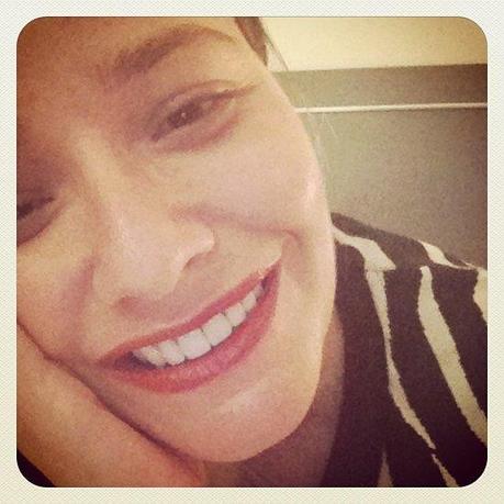 Tetraciclina, la culpable de mi mayor complejo (2ª parte) carillas detalle