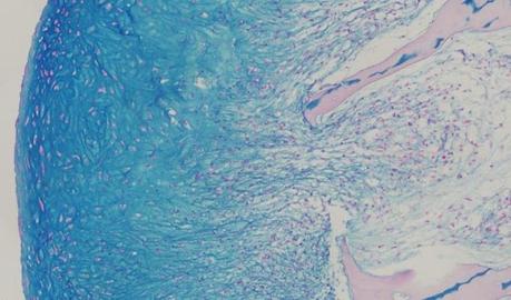 Ingenieros crecen cartílago humano funcional en el laboratorio Cartilago en laboratorio