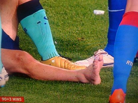 messitobillo Messi protagonizó el susto de la jornada: 20 días afuera