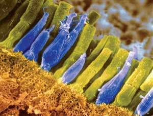 Retinal cone cells transplanted into blind mice Retinal cone cells transplanted into blind mice