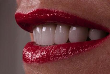 Tetraciclina, la culpable de mi mayor complejo (3ª parte) detalle de las carillasde Arantza