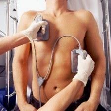 ¿Por qué se produce la Arritmia Cardíaca?