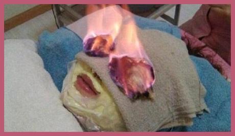 FUEGO FACIAL para eliminar las arrugas 1362771208 787 FUEGO FACIAL para eliminar las arrugas