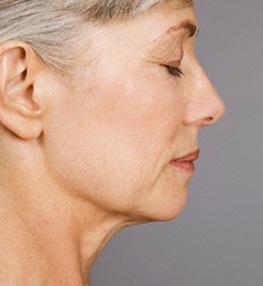 Rejuveneciendo nuestro rostro con el Yoga Rejuveneciendo nuestro rostro con el Yoga