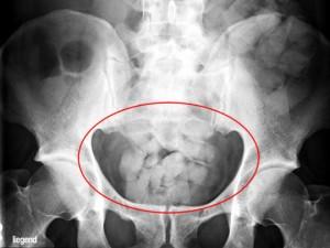 Objetivo cocaína: Grupo de Estupefacientes de Barajas radiografia b-n 2