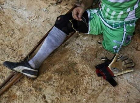 Un portero de fútbol con una sola pierna. Un ejemplo de superación. Un portero de fútbol que juega con una sola pierna